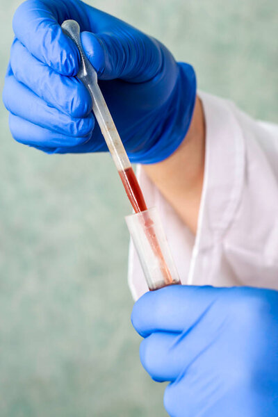 a medical worker in a white coat and blue gloves draws blood from a test tube with a pipette for analysis. High quality photo