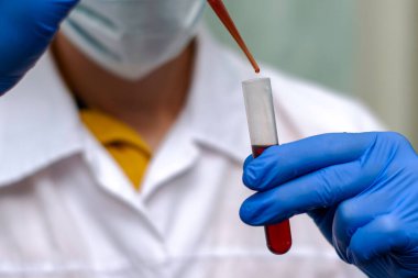 Beyaz önlüklü ve mavi eldivenli bir tıp çalışanı analiz için pipetli bir test tüpünden kan alıyor. Yüksek kalite fotoğraf