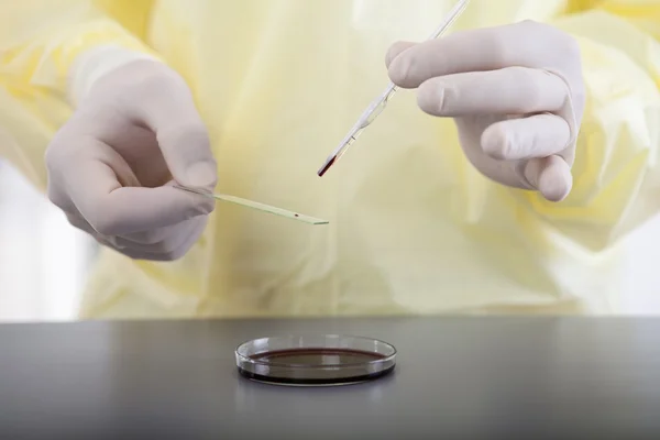 Pipeta de laboratorio sobre placas Petri rellenas de rojo — Foto de Stock