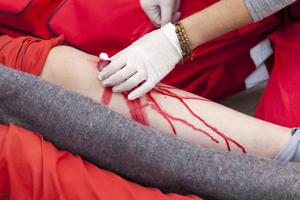 Tratamiento médico de lesiones en las piernas —  Fotos de Stock