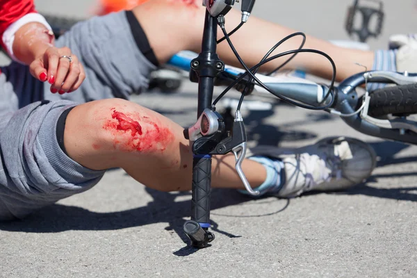 Queda de bicicleta lesões — Fotografia de Stock