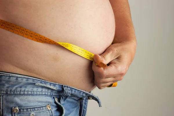 Gordo obeso. El hombre sostiene su barriga demasiado gorda. Riesgo para la salud de la obesidad . —  Fotos de Stock