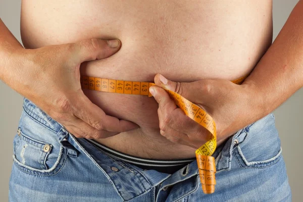 Gordo obeso. El hombre sostiene su barriga demasiado gorda. Riesgo para la salud de la obesidad . — Foto de Stock