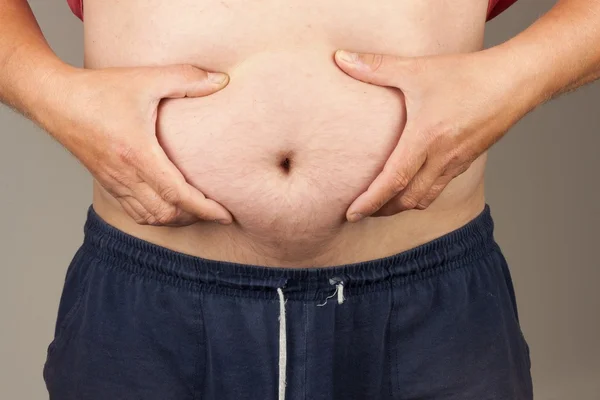 Gordo obeso. El hombre sostiene su barriga demasiado gorda. Peligro de obesidad para la salud. salud y concepto de personas — Foto de Stock