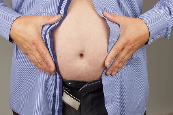 Gordo obeso. El hombre sostiene su barriga demasiado gorda. Peligro de obesidad para la salud. salud y concepto de personas — Foto de Stock