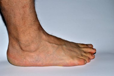 Bir adamın sağ ayağının yan görüntüsü. Yüksek kalite fotoğraf