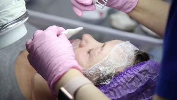 Gesicht mit einer Laser-Hautbehandlung, eine wiederbelebende Technik für Falten — Stockvideo