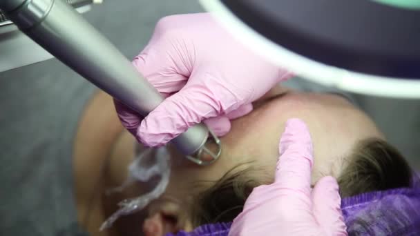 Gesicht mit einer Laser-Hautbehandlung, eine wiederbelebende Technik für Falten — Stockvideo