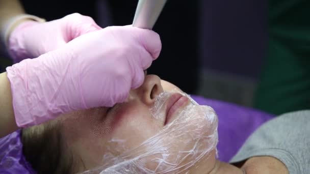 Twarz po laserowej obróbce skóry, Technika nawierzchni zmarszczek — Wideo stockowe