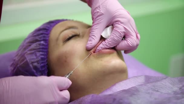 Procedura di aumento delle labbra. iniezioni di bellezza. Chirurgia plastica — Video Stock
