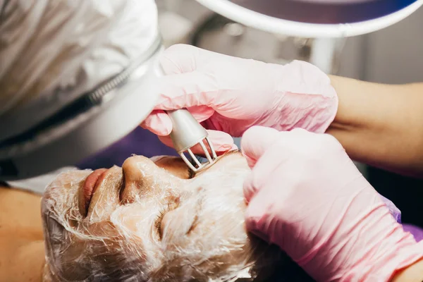 Cosmetologist Εκτελεί Διαδικασία Αναζωογόνησης Λέιζερ Κοντινό Πλάνο Κλασματικό Λέιζερ Co2 Εικόνα Αρχείου