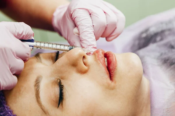 Женщина получает инъекцию гиалуроновой кислоты в качестве кожного наполнителя для увеличения губ Лицензионные Стоковые Изображения