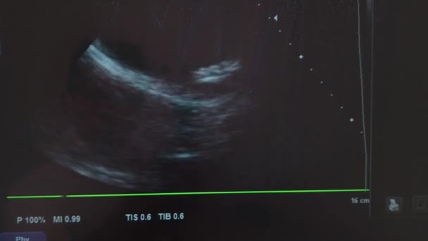 Ultrasound medical video widh live display showing tissue — Stock Video