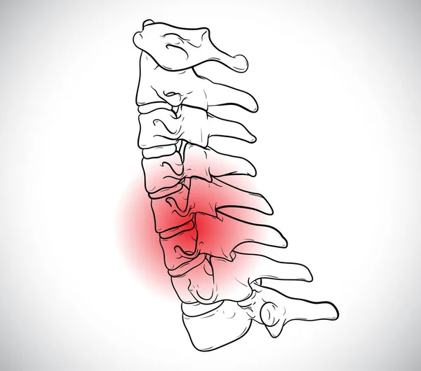 颈椎的医学上正确的椎体 — 图库矢量图片