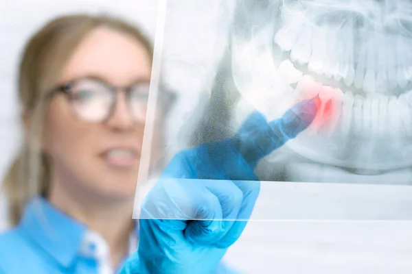 Dentista Mulher Close Olha Para Uma Imagem Raio Panorâmica Uma Imagens Royalty-Free