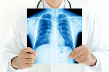 Normal erkek göğüs x-ray görüntüsünü tutan doktor