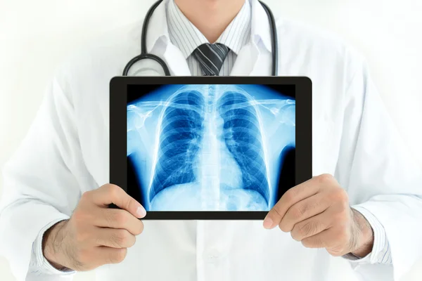 Médico segurando tablet pc com imagem normal de raio-x de tórax masculino — Fotografia de Stock