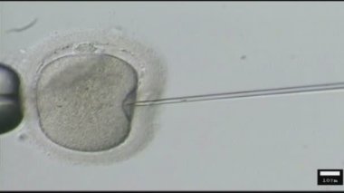 Bir kadın sperm enjekte