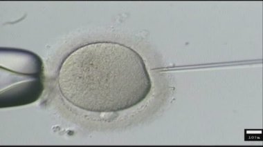 Bir kadın sperm enjekte