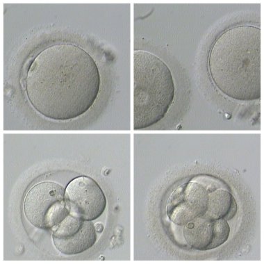 İnsan IVF