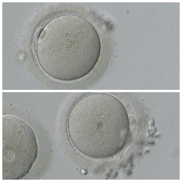 Menselijke Ivf — Stockfoto