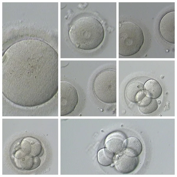 Menselijke Ivf — Stockfoto