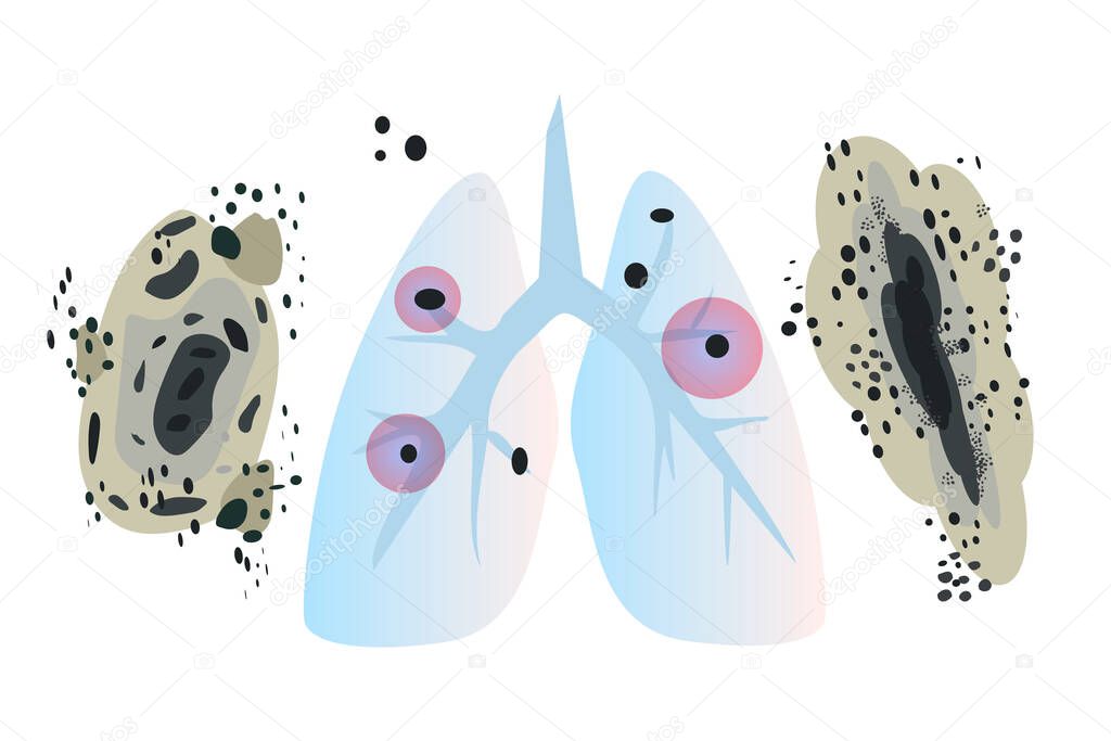 Humans lungs with fungi Aspergilloma Black mold colonies, allergenic black mildew spots, dark fungus colonies isolated, wall mouldiness, mustiness, rot. Flat vector illustration isolated on white