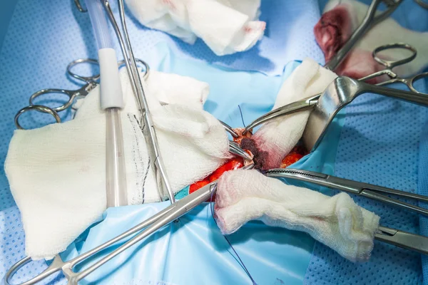 Herramientas de equipo quirúrgico en operación hospitalaria —  Fotos de Stock