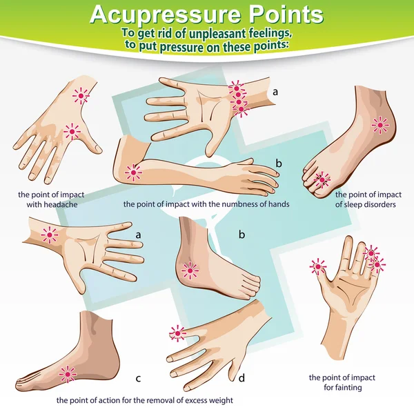 Terapia de masaje Puntos de Acupresión — Vector de stock