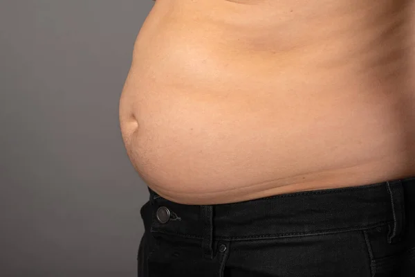 灰色の背景の前で若い男の肥大した胃の写真を閉じます — ストック写真