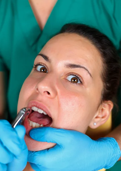 Diş çıkarma — Stok fotoğraf
