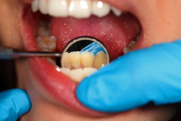 Examen dental — Foto de Stock