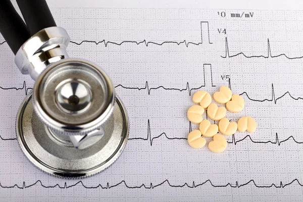 Electrocardiograma — Foto de Stock