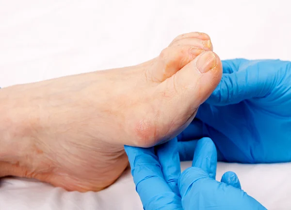 Elderly feet care — Stock Photo, Image