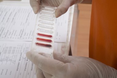 test laboratuvarı