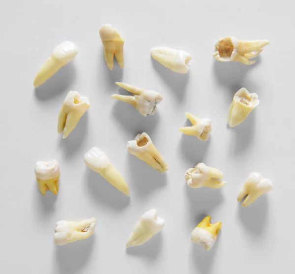 Denti umani radice remota — Foto Stock