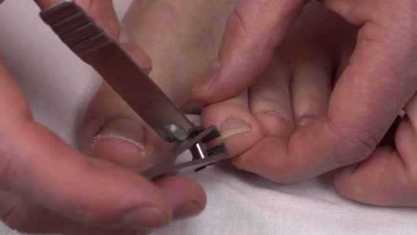 Un homme se coupe les ongles des orteils en gros plan. Les ongles de champignon sont coupés avec des pinces spéciales. — Video