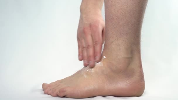 Un bărbat frotiază unguent pe un picior pe care se află o higromă. Hernie articulară pe picior . — Videoclip de stoc