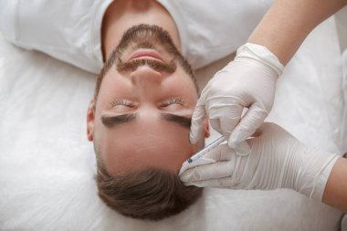 Sakallı bir adamın güzellik uzmanının yaptığı iğnelerle saç dökülme tedavisinin en üst görüntüsü.