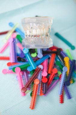 Diş telleri için renkli elastik yığınının üzerindeki takma dişlerin dikey yakın plan modeli