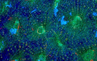 Acanthastrea echinata çok renkli