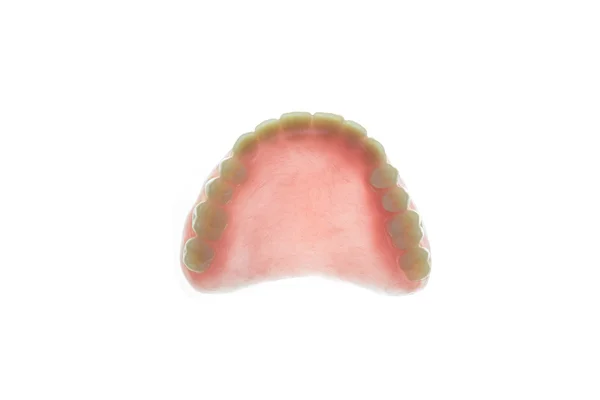 Prótesis dentales sobre fondo blanco — Foto de Stock