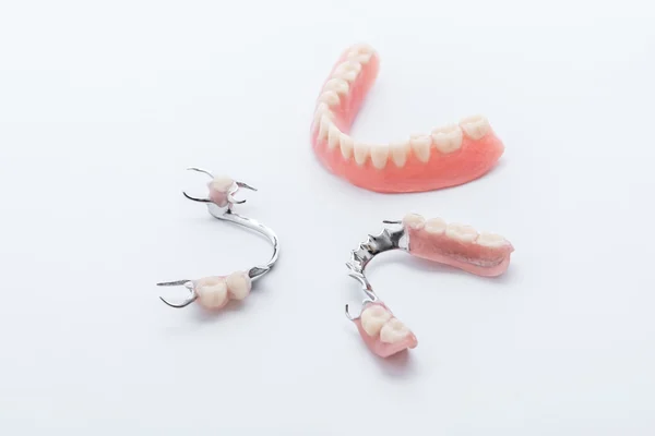 Conjunto de dentaduras no fundo branco — Fotografia de Stock