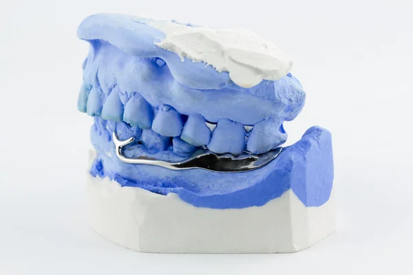 Fili dentali piegati per fare una protesi parziale — Foto Stock