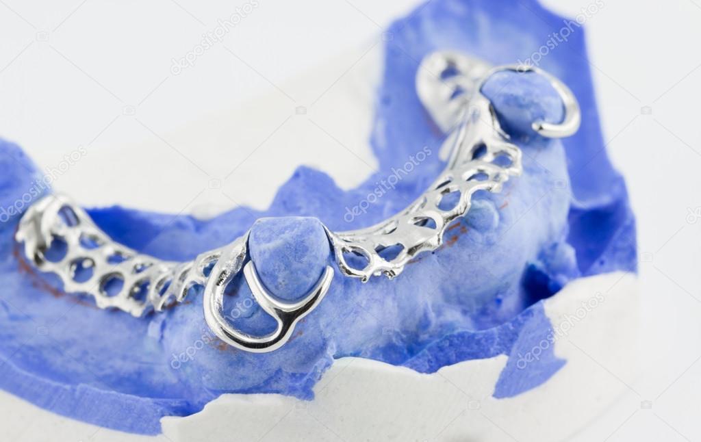 Dental wire bending for make a partial denture ⬇ Stock Photo, Image by