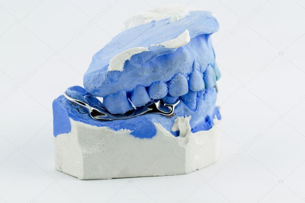  a partial denture