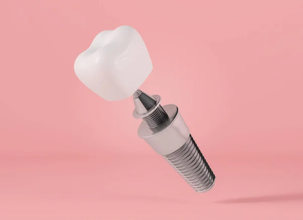 Dental implant on pink background, 3d rendering