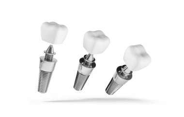 Diş implantı beyaz arkaplandan izole edildi