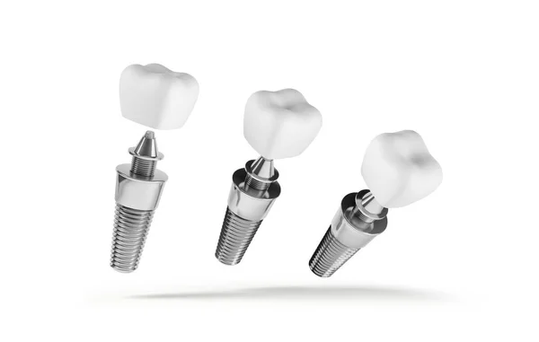 Diş implantı beyaz arkaplandan izole edildi