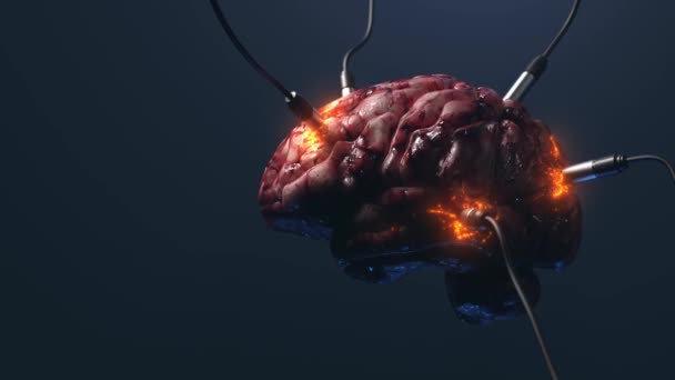 Искусственный Интеллект Изображение Мозга Различными Датчиками Подключенными Нему Передающими Принимающими — стоковое видео